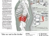 spinalpain